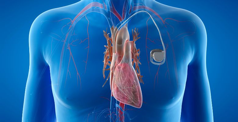 Insuficiência cardíaca é agravada diretamente por diabetes tipo 2