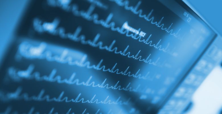 Aliança iCARDIO lança inquérito sobre fibrilhação auricular para influenciar próximas recomendações